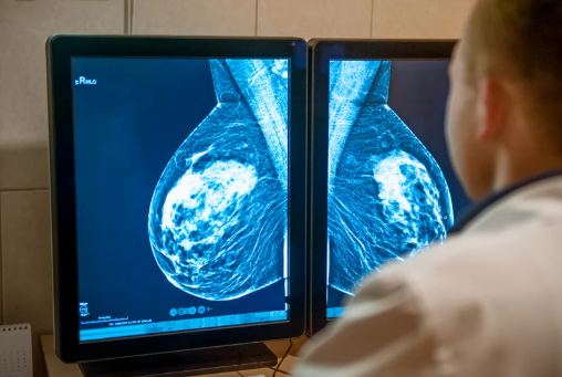 Mamografías gratis impulsan la detección temprana del cáncer de mama en Las Vegas